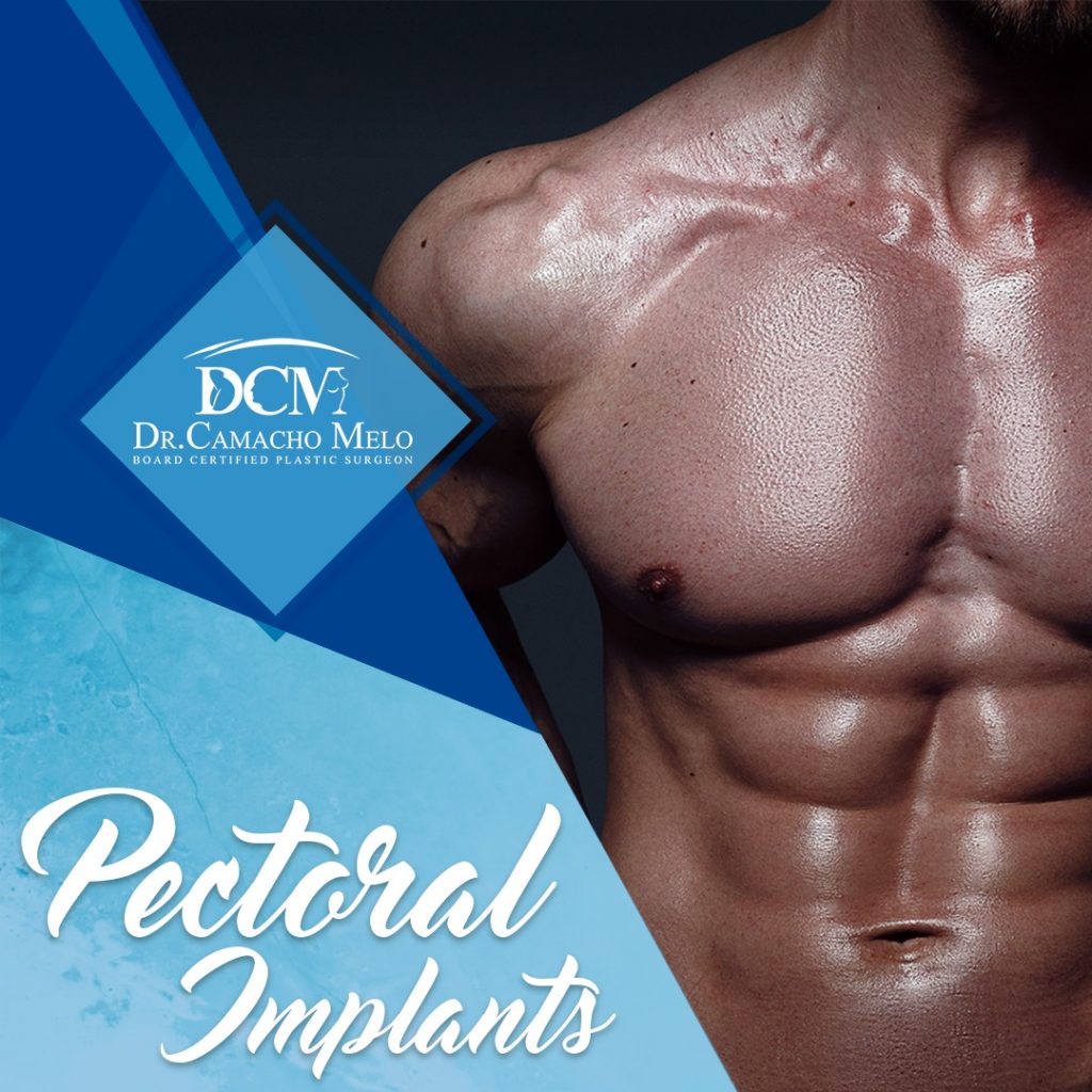 pectoral implants in Tijuana